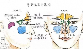 鼻炎鼻塞怎么办 鼻炎鼻塞怎么办怎样让鼻通气