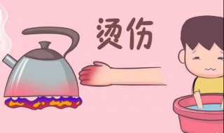 宝宝烫伤怎么办（小孩烫伤用什么办法）