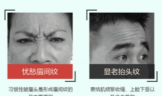 抬头纹太深怎么改善（抬头纹太深怎么消除）