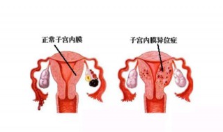 宫颈在哪个位置 宫颈在哪个位置能摸到吗