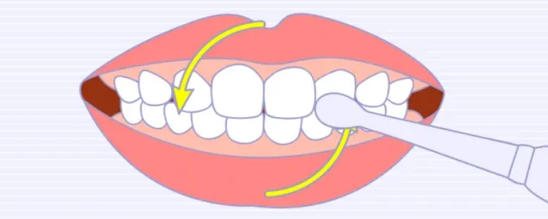 圆弧刷牙法（圆弧刷牙法适合几岁）