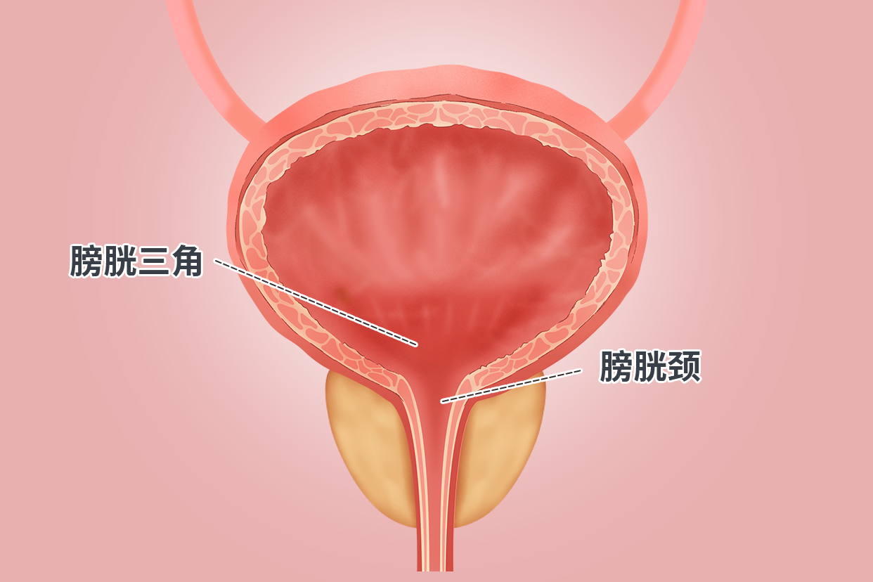 膀胱颈和膀胱三角解剖图 膀胱颈和膀胱三角解剖图解