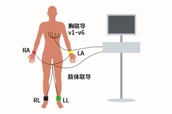 心电图四肢位置图片（心电图四肢位置图片女性）