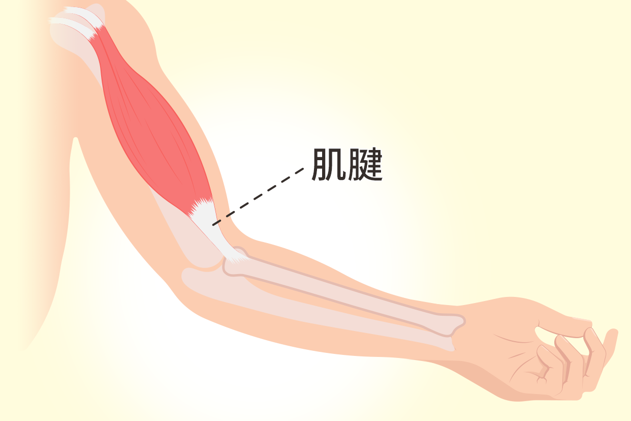 肌腱和韧带的区别图片 肌腱和韧带的区别图片大全