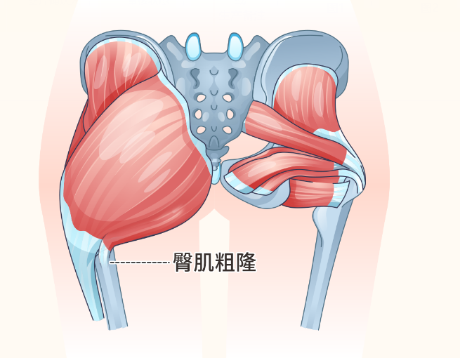 臀肌粗隆在哪个位置图片 臀肌粗隆在哪个位置图片