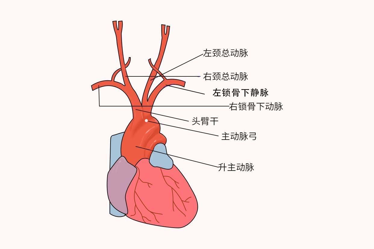 主动脉弓位置示意图 主动脉弓的位置图片