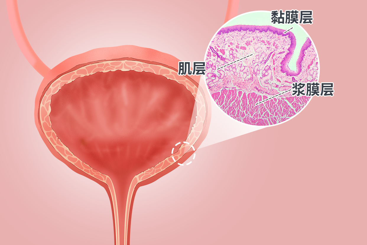 膀胱壁分层示意图