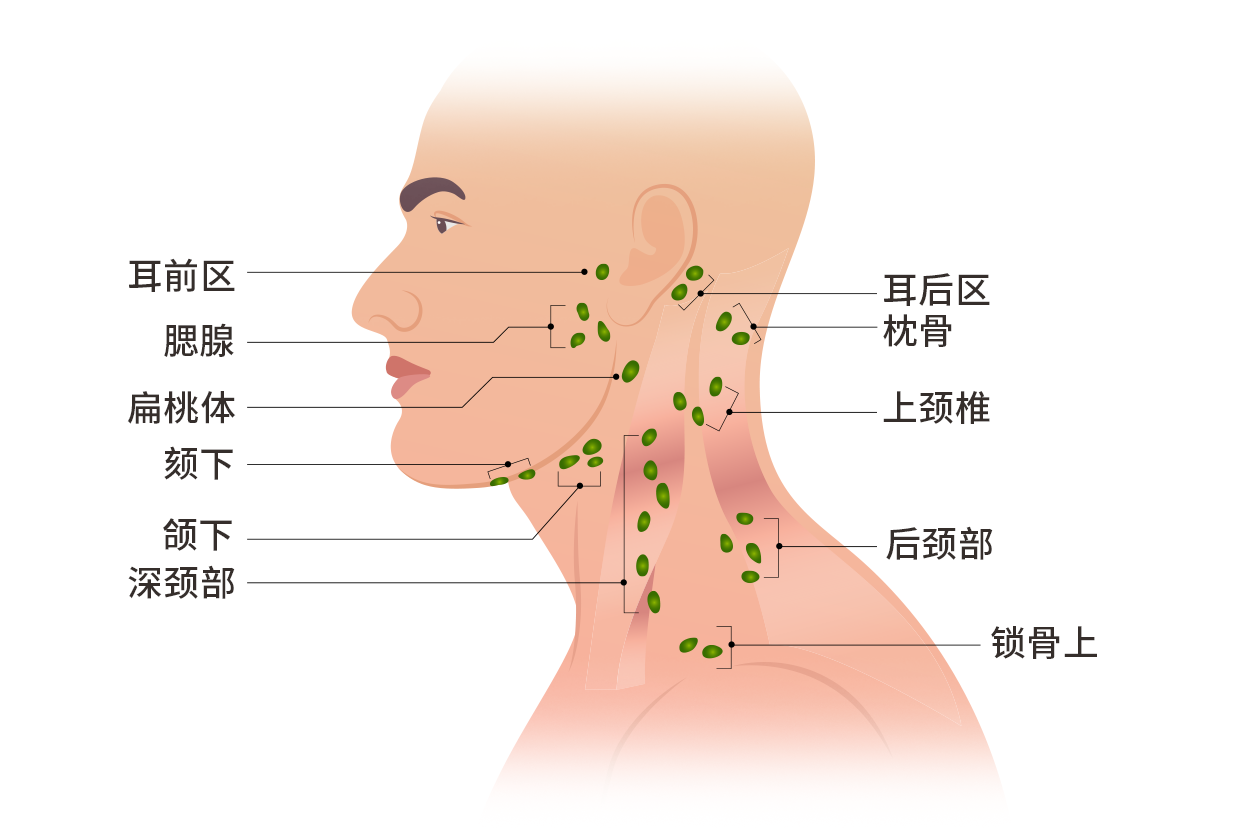 左脸淋巴结位置图片 脸部淋巴结在哪个位置图片