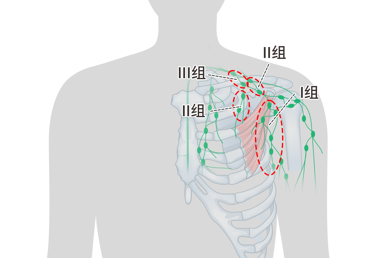 中央区淋巴结图片（中央淋巴区位置）