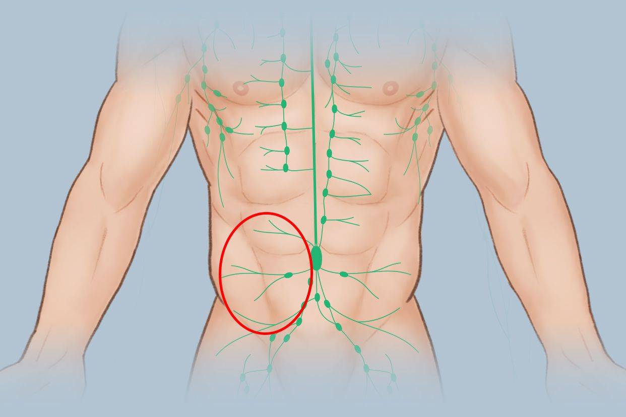 左腹部淋巴结位置图片 左腹部淋巴结位置图片男性