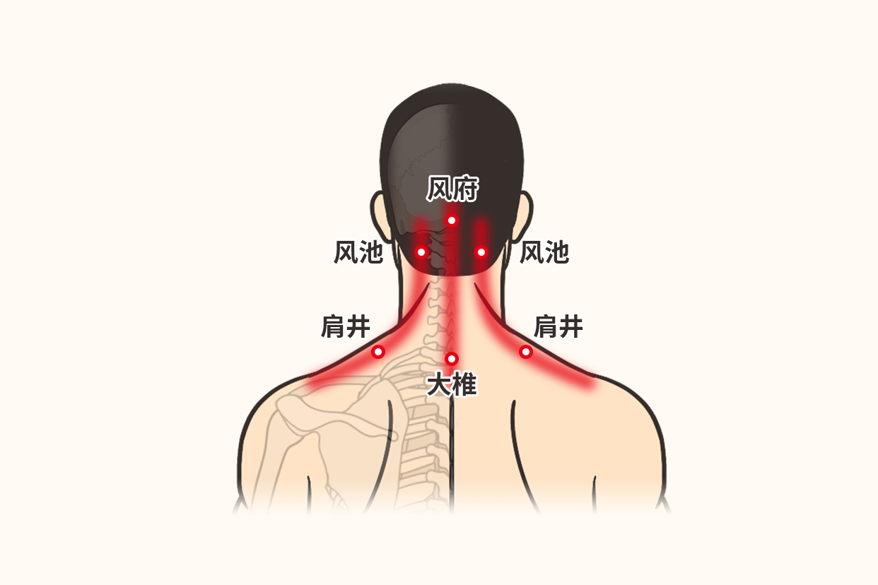 感冒头痛刮痧刮什么部位图（刮痧治感冒的部位图解）