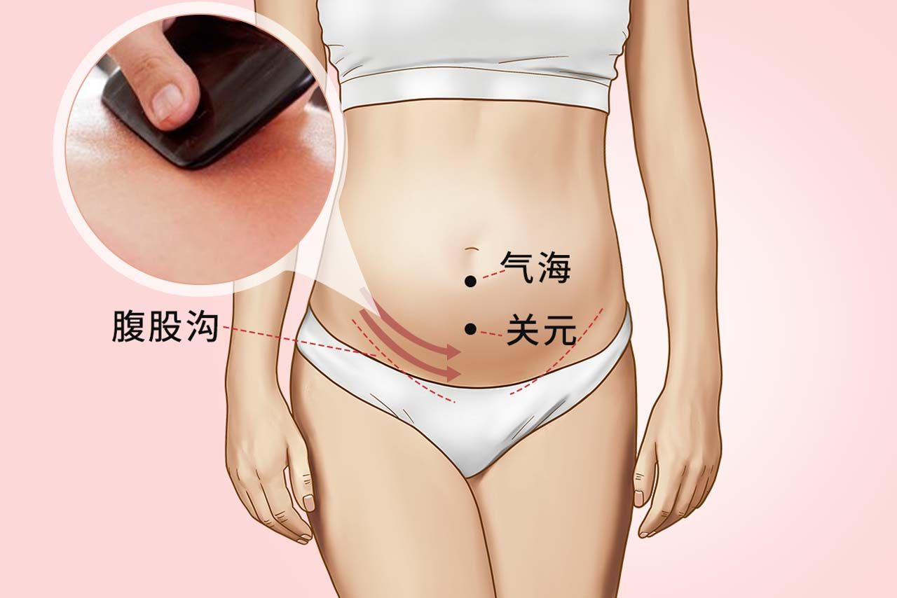 女性腹股沟刮痧图片（女性腹股沟刮痧）