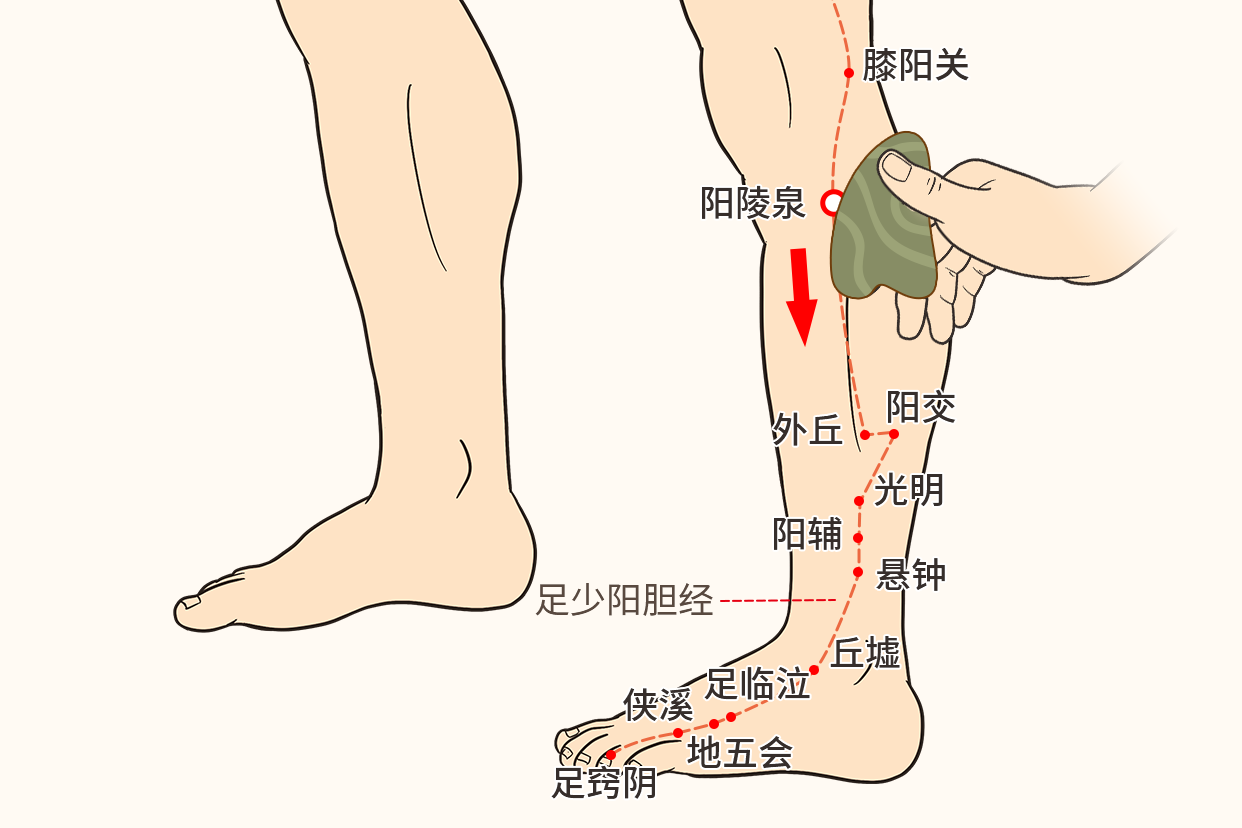 肝胆湿热刮痧示意图 肝胆湿热最怕三种食物