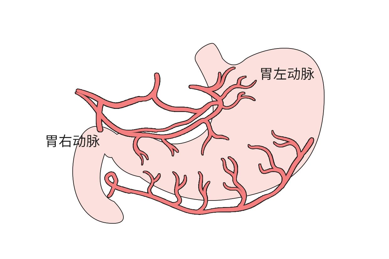 胃血管解剖图高清图