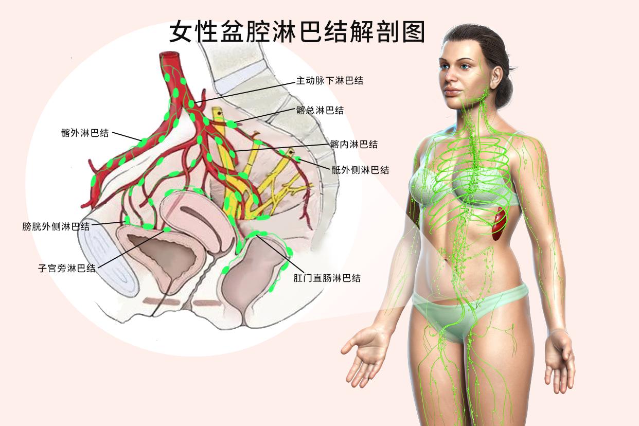 女性盆腔淋巴结解剖图 女性盆腔淋巴结解剖图谱