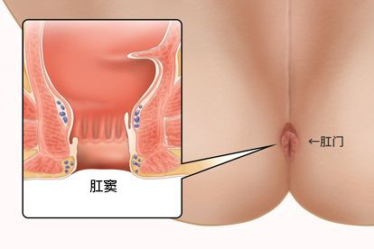 肛窦解剖图 肛窦示意图