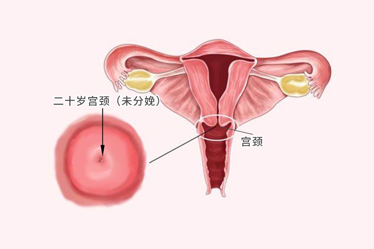 二十岁宫颈图片（20岁女生宫颈大是什么原因）